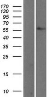 Western Blot: TBX5 Overexpression Lysate [NBL1-16750]