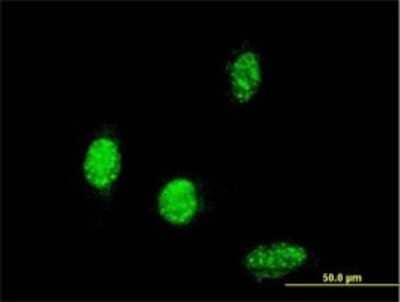 Immunocytochemistry/ Immunofluorescence: TBX6 Antibody (2D11) [H00006911-M01]