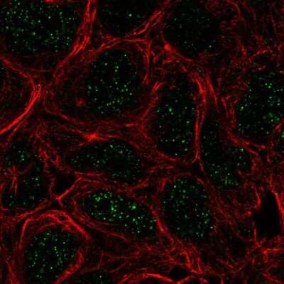 Immunocytochemistry/ Immunofluorescence: TBX6 Antibody [NBP2-68792]