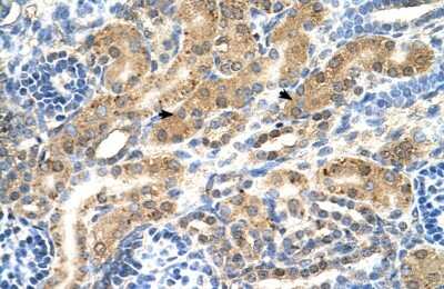 Immunohistochemistry-Paraffin: TC-PTP/PTPN2 Antibody [NBP1-60066]