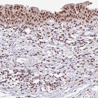 Immunohistochemistry-Paraffin: TC-PTP/PTPN2 Antibody [NBP2-48528]