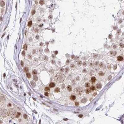 Immunohistochemistry-Paraffin: TC-PTP/PTPN2 Antibody [NBP2-48528]