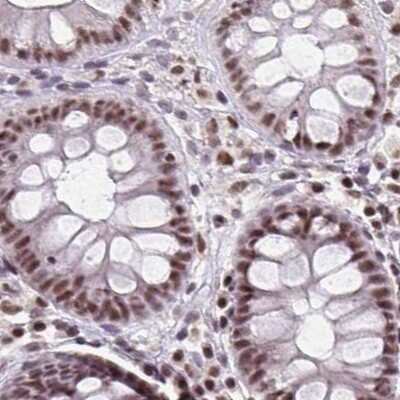 Immunohistochemistry-Paraffin: TC-PTP/PTPN2 Antibody [NBP2-48528]