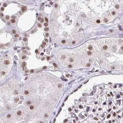 Immunohistochemistry-Paraffin: TC-PTP/PTPN2 Antibody [NBP2-48528]