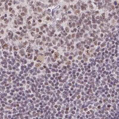 Immunohistochemistry-Paraffin: TC-PTP/PTPN2 Antibody [NBP2-48528]