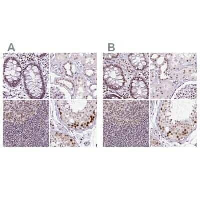 Immunohistochemistry-Paraffin: TC-PTP/PTPN2 Antibody [NBP2-48841]