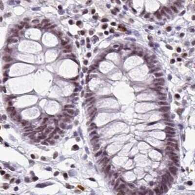 Immunohistochemistry-Paraffin: TC-PTP/PTPN2 Antibody [NBP2-48841]