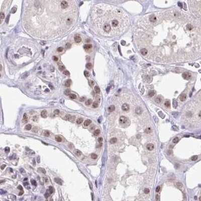 Immunohistochemistry-Paraffin: TC-PTP/PTPN2 Antibody [NBP2-48841]
