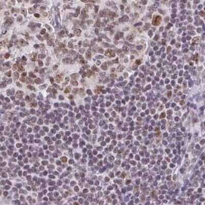 Immunohistochemistry-Paraffin: TC-PTP/PTPN2 Antibody [NBP2-48841]