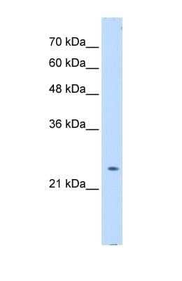 Western Blot: TC-PTP/PTPN2 Antibody [NBP1-60066]