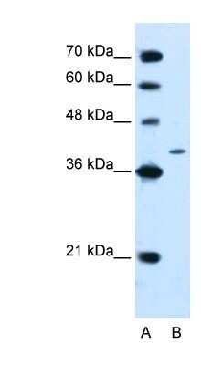 Western Blot: TC-PTP/PTPN2 Antibody [NBP1-60093]