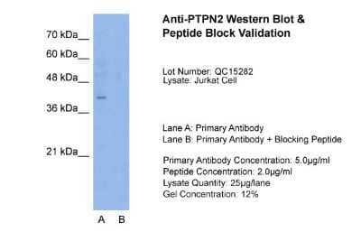 Western Blot: TC-PTP/PTPN2 Antibody [NBP1-60093]
