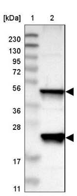 Western Blot: TC-PTP/PTPN2 Antibody [NBP2-48528]