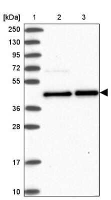 Western Blot: TC-PTP/PTPN2 Antibody [NBP2-48841]