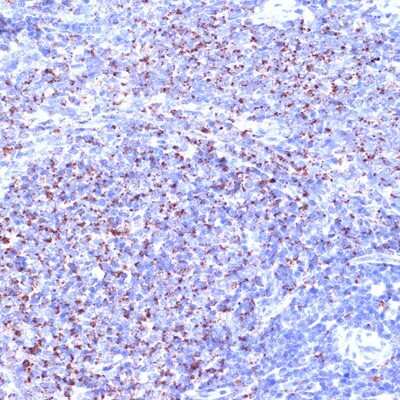 Immunohistochemistry-Paraffin: TC10 Antibody (10F7Y7) [NBP3-15915]