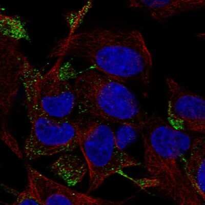 Immunocytochemistry/ Immunofluorescence: TC10 Antibody [NBP2-55239]