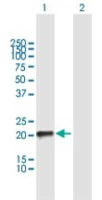 Western Blot: TC10 Antibody [H00023433-B01P]