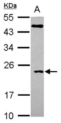 Western Blot: TC10 Antibody [NBP2-15134]