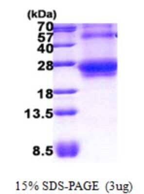 SDS-PAGE: Recombinant Human TC10 His Protein [NBP2-23399]