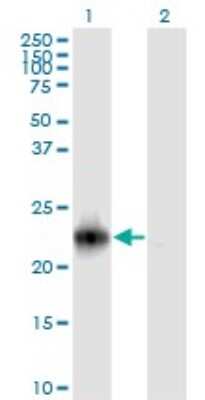 Western Blot: TC21/R-Ras2 Antibody (2D3-4B8) [H00022800-M01]