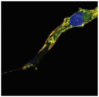 Immunocytochemistry/ Immunofluorescence: TC21/R-Ras2 Antibody (EM-50) [NBP2-62216]