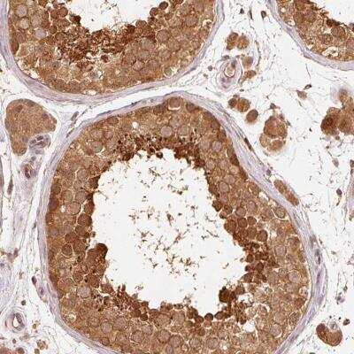 Immunohistochemistry-Paraffin: TC21/R-Ras2 Antibody [NBP2-38639]