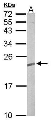 Western Blot: TC21/R-Ras2 Antibody [NBP1-32919]