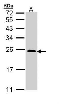 Western Blot: TC21/R-Ras2 Antibody [NBP1-32919]