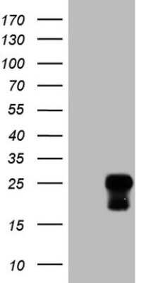 Western Blot: TCAP Antibody (OTI11H10) [NBP2-46084]