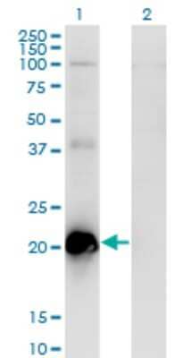 Western Blot: TCAP Antibody (1H3) [H00008557-M03]