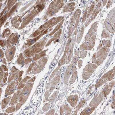 Immunohistochemistry-Paraffin: TCAP Antibody [NBP1-85544]