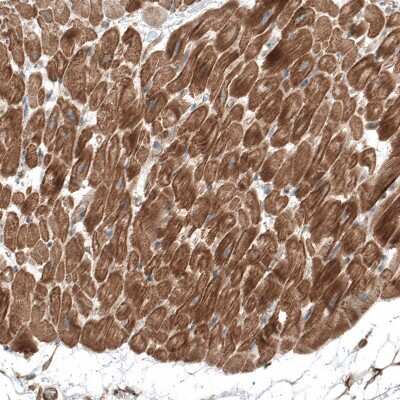 Immunohistochemistry-Paraffin: TCAP Antibody [NBP1-85544]
