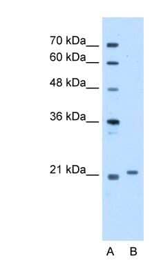 Western Blot: TCAP Antibody [NBP1-56626]