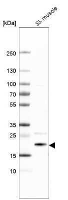 Western Blot: TCAP Antibody [NBP1-85544]