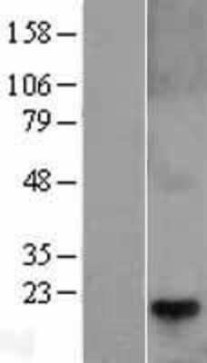 Western Blot: TCAP Overexpression Lysate [NBL1-16755]