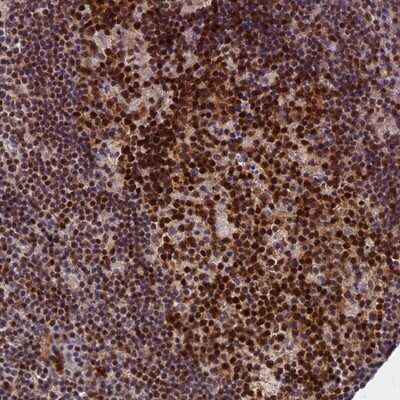 Immunohistochemistry-Paraffin: TCEA1 Antibody [NBP1-93707]