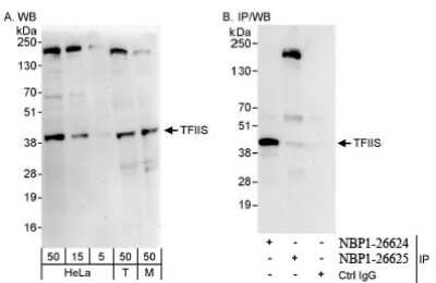 Western Blot: TCEA1 Antibody [NBP1-26625]