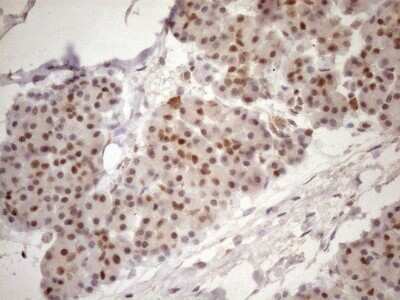 Immunohistochemistry: TCEAL1 Antibody (OTI2G10) [NBP2-46085]