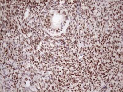 Immunohistochemistry: TCEAL1 Antibody (OTI2G10) [NBP2-46085]