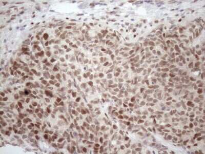 Immunohistochemistry: TCEAL1 Antibody (OTI2G10) [NBP2-46085]