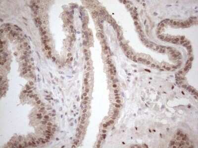 Immunohistochemistry: TCEAL1 Antibody (OTI2G10) [NBP2-46085]