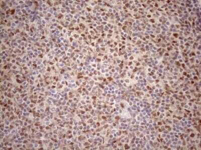 Immunohistochemistry: TCEAL1 Antibody (OTI2G10) [NBP2-46085]