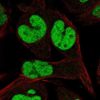 Immunocytochemistry/ Immunofluorescence: TCEAL1 Antibody [NBP2-68762]