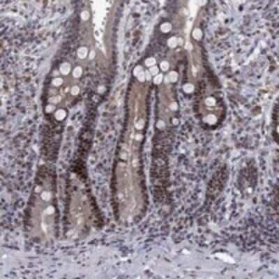 Immunohistochemistry-Paraffin: TCEAL1 Antibody [NBP3-17943]