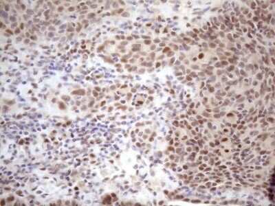 Immunohistochemistry: TCEAL1 Antibody (OTI2G10) - Azide and BSA Free [NBP2-74472]