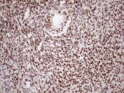 Immunohistochemistry: TCEAL1 Antibody (OTI2G10) - Azide and BSA Free [NBP2-74472]
