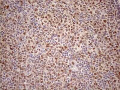 Immunohistochemistry: TCEAL1 Antibody (OTI2G10) - Azide and BSA Free [NBP2-74472]