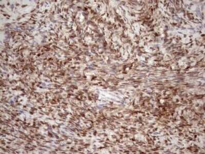 Immunohistochemistry: TCEAL1 Antibody (OTI2G10) - Azide and BSA Free [NBP2-74472]