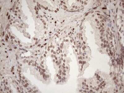 Immunohistochemistry: TCEAL1 Antibody (OTI2G10) - Azide and BSA Free [NBP2-74472]