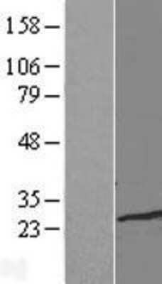 Western Blot: TCEAL1 Overexpression Lysate [NBL1-16758]